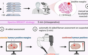 El Laboratorio de Inteligencia Artificial de la UPM participa en un proyecto europeo que revolucionará la cirugía de cáncer de mama