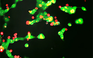 Piezas LEGO a escala nano, una la solución para tratar tumores sólidos