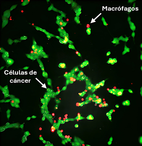 Microscopía electrónica de células de cáncer de neuroblastoma tratadas inicialmente con liposomas y posteriormente macrófagos modificados con liposomas